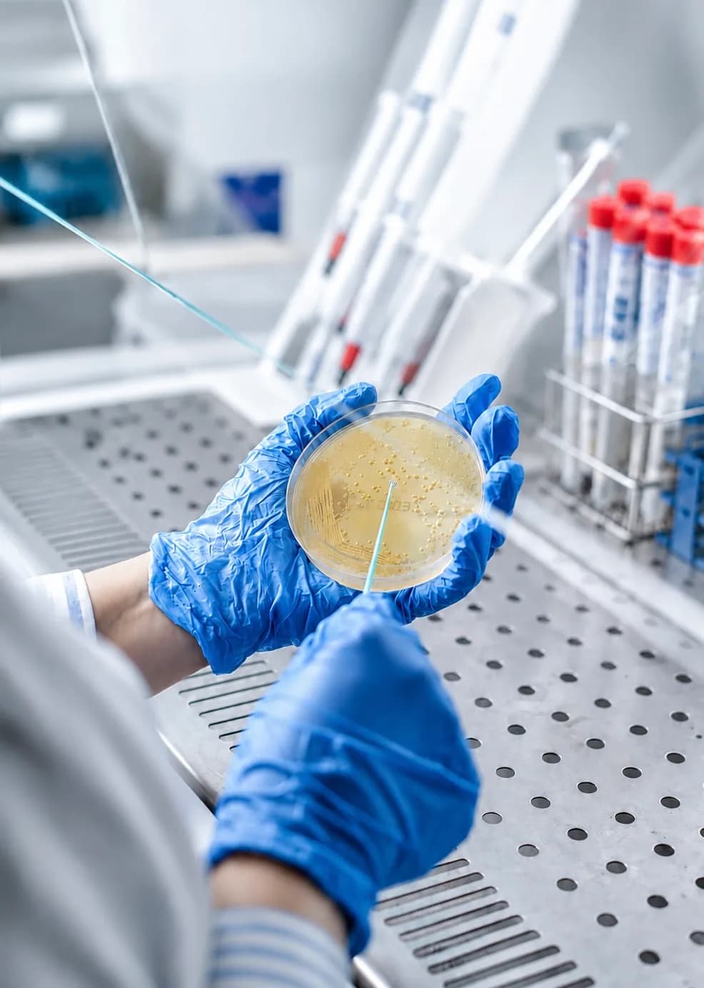 Analyse microbiologique spécialisée sur une boîte de culture